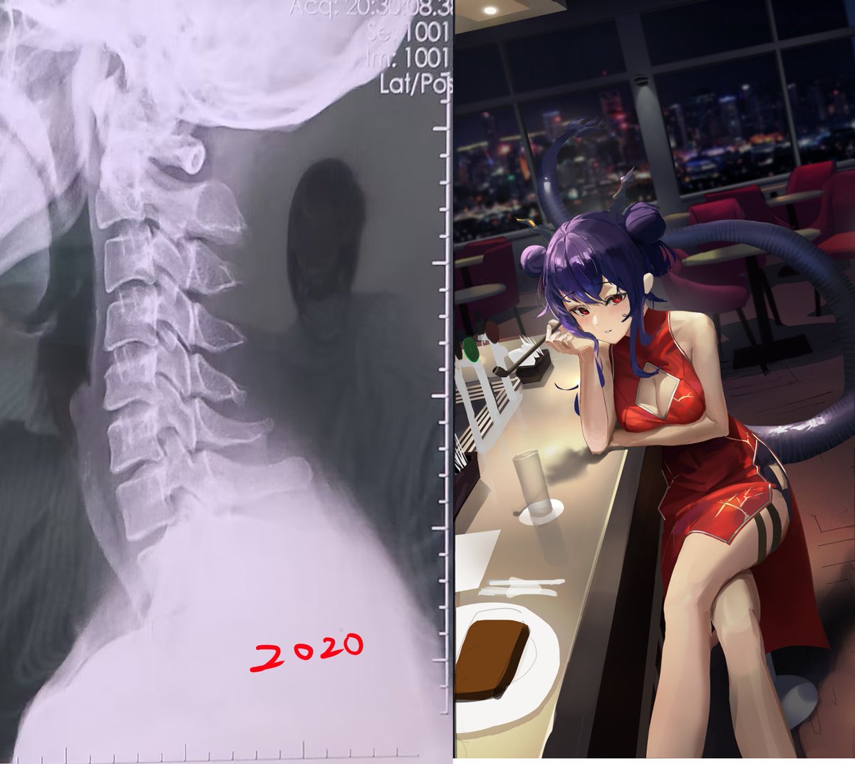 [閒聊] 畫畫的技巧進步了 但脖子歪了